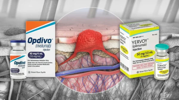Yervoy Opdivo Melanoma