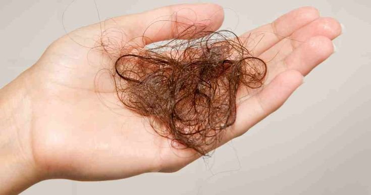 Does Mounjaro Cause Hair Loss? Best Comprehensive Guide 2025 4