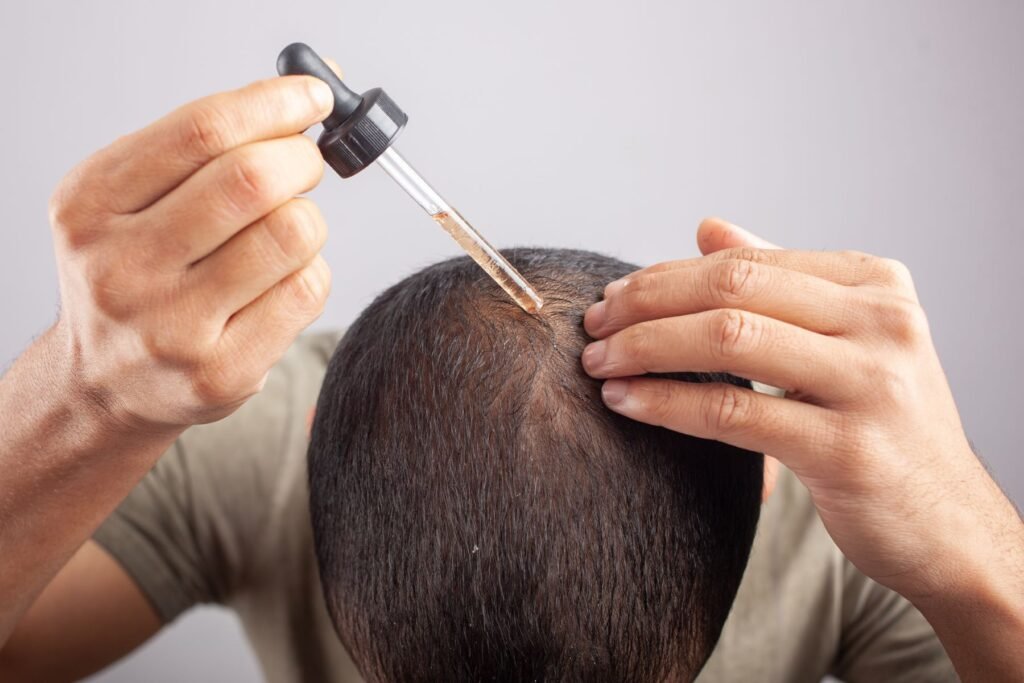 Does Mounjaro Cause Hair Loss? Best Comprehensive Guide 2025 2