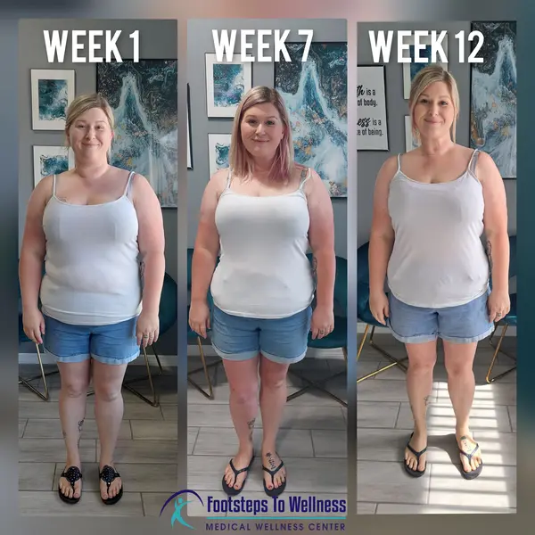 Mounjaro Weight Loss by Week: A Step-by-Step Guide to Your Transformation 2025 3