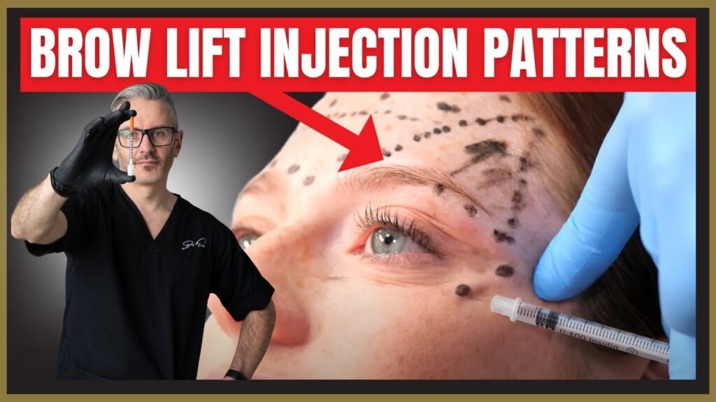 Botox Brow Lift: A Non-Surgical Solution for a Youthful Look 2025 4