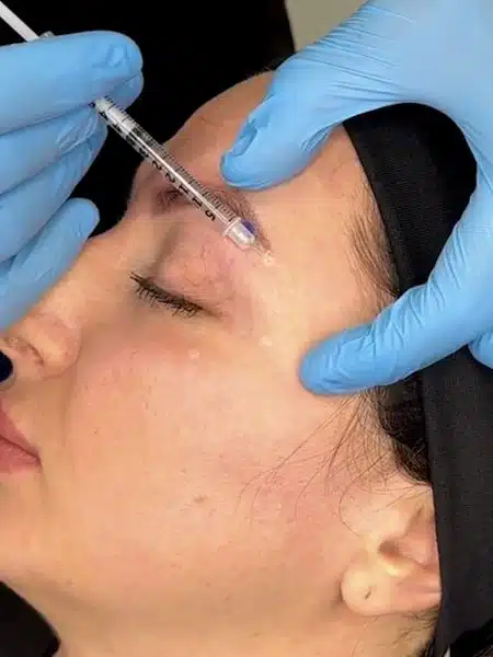 Botox Brow Lift: A Non-Surgical Solution for a Youthful Look 2025 5